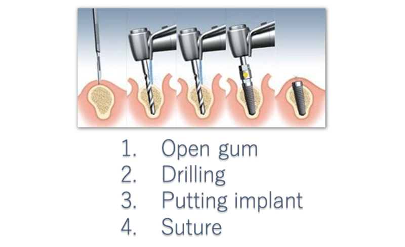 Surgery